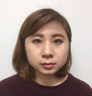 施術前（Before）