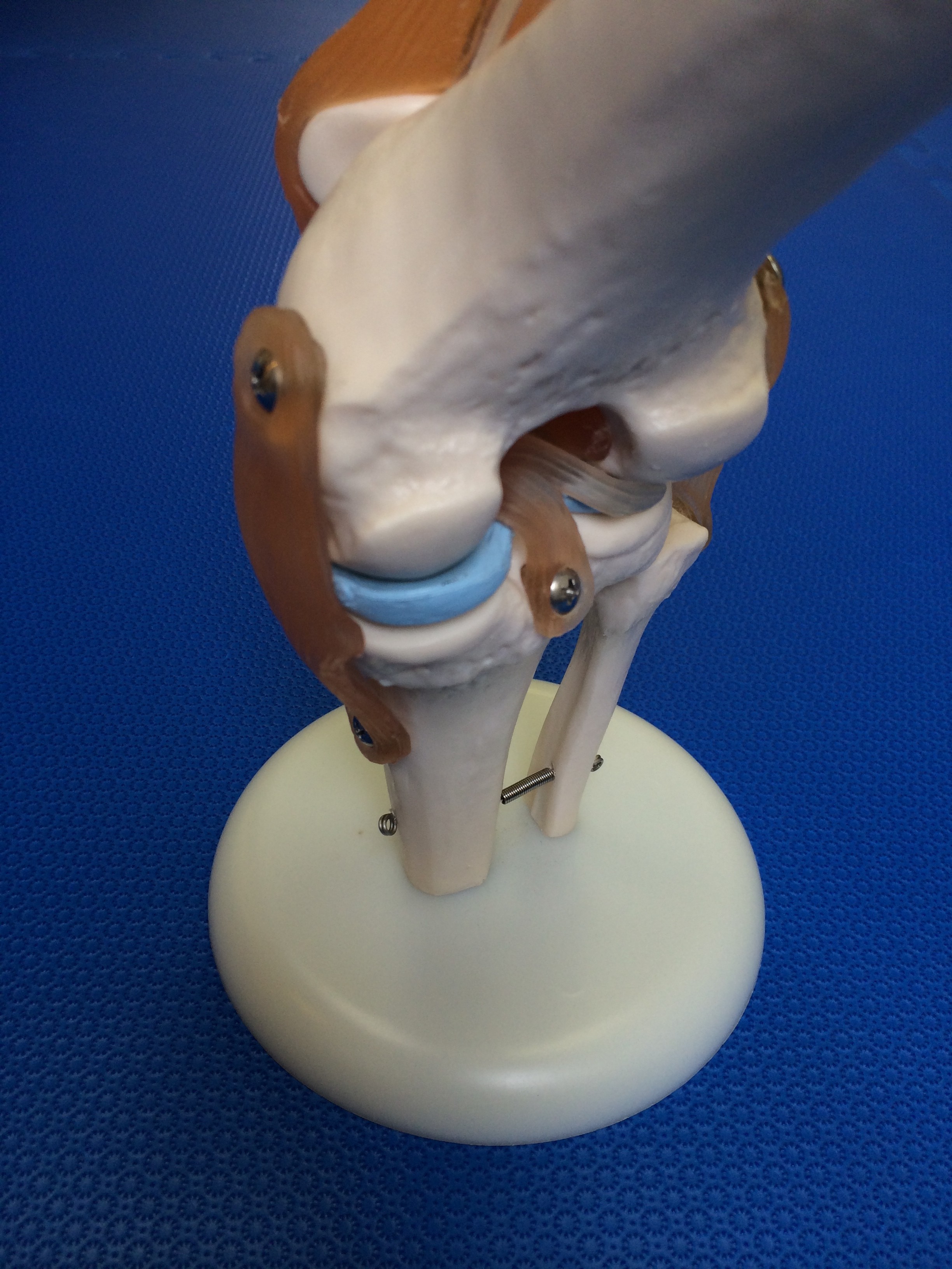 骨模型　膝関節 (4)
