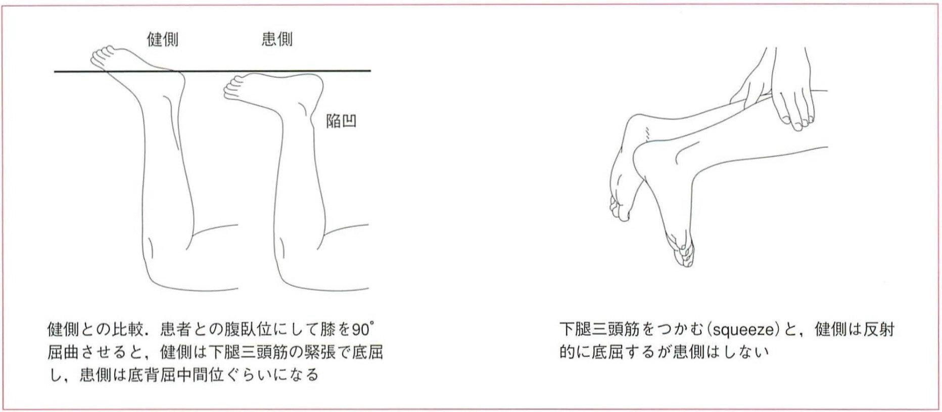 このような方に発生しやすい
