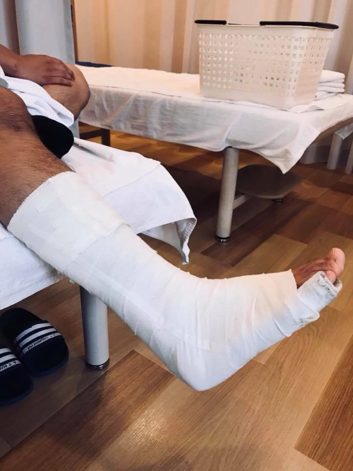 第2度　中程度