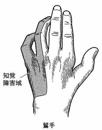 初期症状