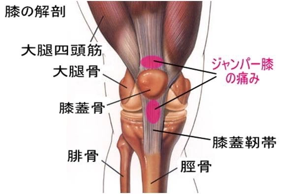 ジャンパー膝の症状