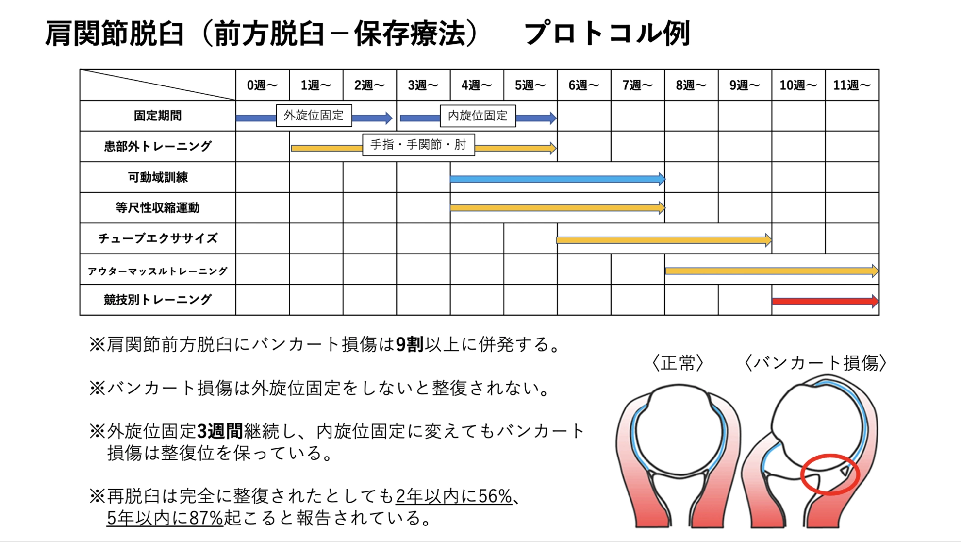 後方脱臼(肩峰下脱臼、棘下脱臼)