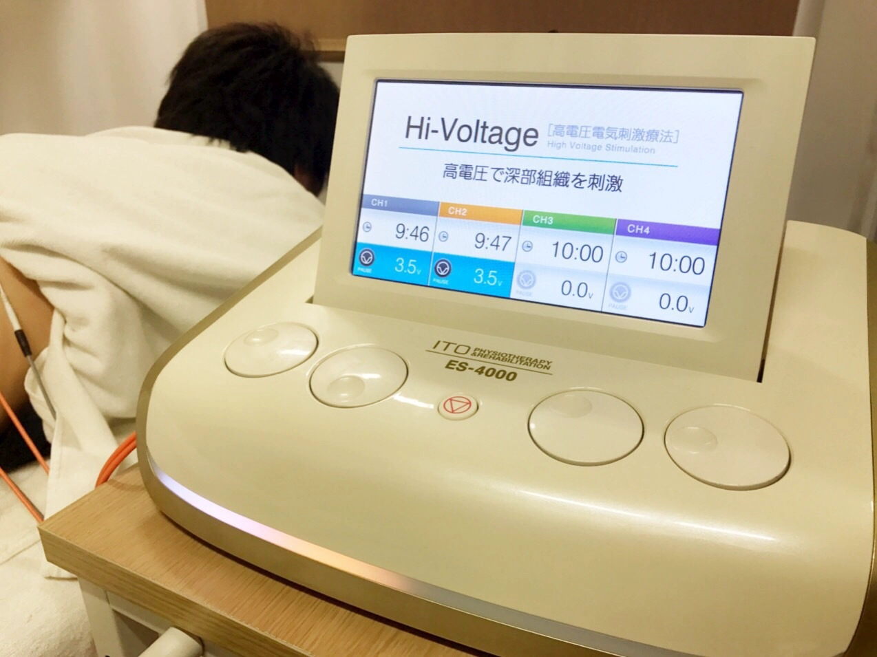 下方脱臼(腋窩脱臼、関節窩下脱臼)