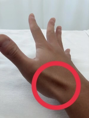 痛みが出る部分は?