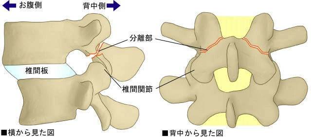 分離症を起こしやすい方
