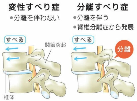 原因を突き止める